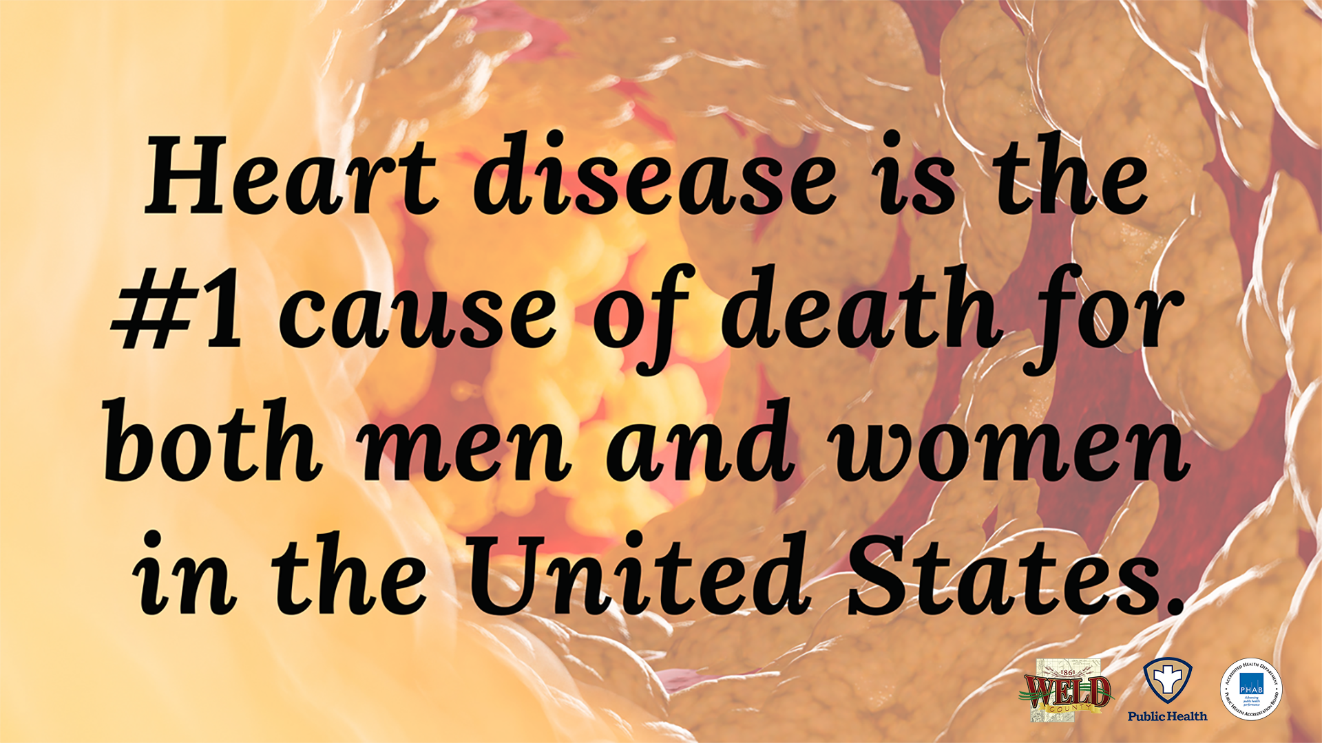 Heart disease is the number one cause of death for both men and women in the United States