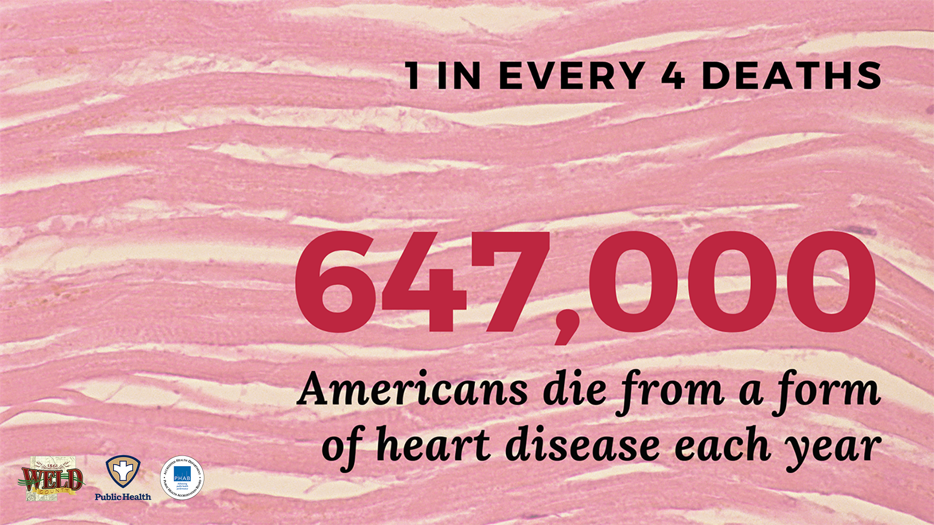 Heart disease causes 1 in every 4 deaths among Americans each year
